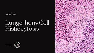 What is Langerhans Cell Histiocytosis [upl. by Iddo]