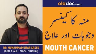 Oral Cancer Symptoms amp Causes Urdu Hindi Munh Ka Cancer Aur Alamaat Ilaj  Mouth Cancer Treatment [upl. by Aihsei]