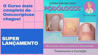 Curso Onicofose Onicocriptose e Granuloma [upl. by Akemeuwkuhc215]