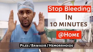 STOP PILES bleeding in 10 minutes  Quick Cure HEMORRHOIDS BAWASIR in 2 days [upl. by Nikolia]