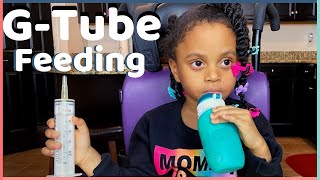 Our GTube Feeding Process  Squeasy  Real Food Blends [upl. by Sherrod]