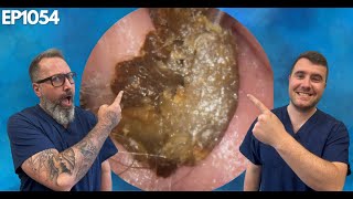 Removing Massive Ear Wax Blockages  EP1054 [upl. by Sinnoda]