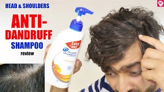 Head amp Shoulders ANTI DANDRUFF Shampoo review  Side Effects Benefits Effect  QualityMantra [upl. by Regen]