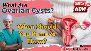 What Are Ovarian Cysts  When Should You Remove Them  TheFibroidDoc  Dr Cheruba Prabakar [upl. by Fay625]