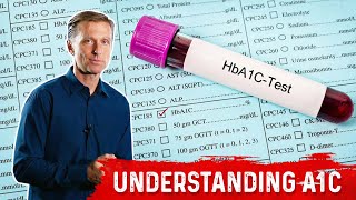 What is A1C Test Is it an Accurate Blood Test – DrBerg [upl. by Yojal]