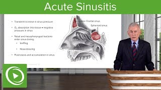 Acute Sinusitis – Infectious Diseases  Lecturio [upl. by Olegnaleahcim]