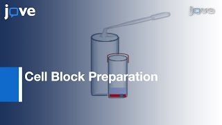 Cytology Specimen Predominance Of Individually Scattered Cells l Protocol Preview [upl. by Niamart]