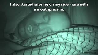 VitalSleep Stop Snoring Mouthpiece Review Live Results [upl. by Ilenay55]