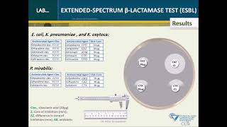 Extendedspectrum betalactamase ESBL test [upl. by Werdnaed411]