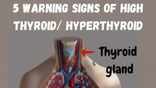 Warning signs of hyperthyroid symptoms of high thyroid thyroid ke lakshan thyroid [upl. by Scott]