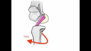 ACL Anatomy [upl. by Libenson]