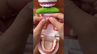 TemporaryJXEJXO thermoplastic beads Tooth Repair Kitdiscount 🦷hole teethrepaircheapsavemoney [upl. by Anod]