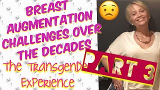 Trans Breast Surgery Decades Later Pt3  MTF SRS 57 year Transgender Transition [upl. by Ocisnarf]