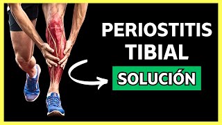 Guía Definitiva para CURAR la PERIOSTITIS TIBIAL Paso a Paso [upl. by Os]