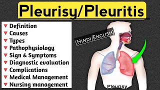 PleurisyPleuritis lecture in Hindi and English medical nursingcriteria pleuritis paramedical [upl. by Forward732]