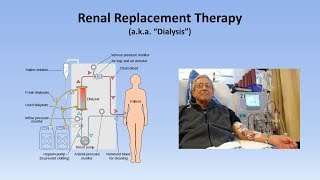 Acute Kidney Injury Part 33  Treatment and Complications [upl. by Gerda461]