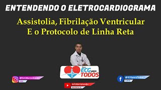 ECG  Eletrocardiograma com Fibrilação Atrial e Alta Resposta Ventricular [upl. by Evanthe789]