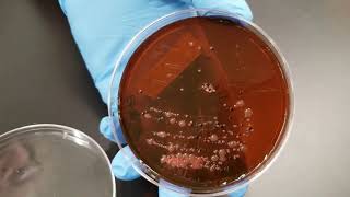 Ecoli amp Coliform bacteria in Drinking Water [upl. by Weksler]