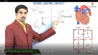 Atrial Septal Defect ASD USMLE Step 1 Pathophysiology [upl. by Ymmac]