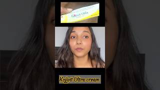 How to Use Kojivit Ultra Cream for Skin Brightening Full Guide amp Results skincare brighterskin [upl. by Eesac]