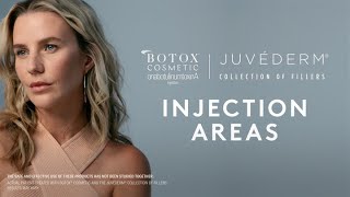 Injection Areas 101  What areas do BOTOX® Cosmetic or JUVÉDERM® Fillers treat [upl. by Aitnic]