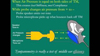 The Tympanogram [upl. by Hearsh832]