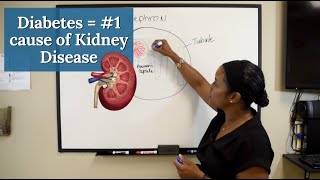 Diabetes is the Number 1 cause of Chronic Kidney Disease Diabetic Kidney Disease  CKD series 2 [upl. by Oakman]