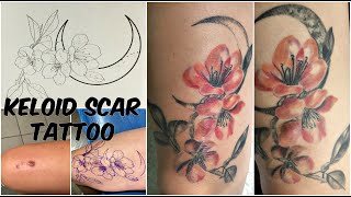 Keloid Scar Tattoo CoverUp Story amp Tips [upl. by Zulaledairam]