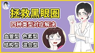 黑眼圈有救了！教你分辨后去除！简单4招，科学有效！ ｜DrBeauty护肤博士王美丽 黑眼圈 [upl. by Assertal]