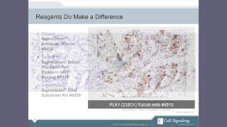 Immunohistochemistry IHC Tips and Techniques [upl. by Sandstrom]