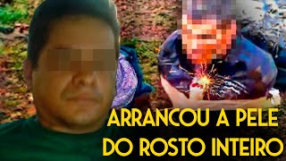 O Assassino Mais Temido de El Mencho que Arrancou a Pele do Rosto de Suas Vítimas e Filmou [upl. by Higginbotham351]