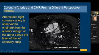 Coronary Arteries and CMR From a Different Perspective  Leila Rezai Gharai MD [upl. by Akeemat]