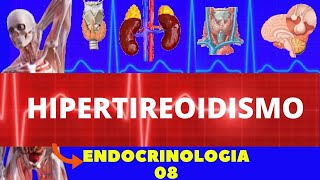 HIPERTIREOIDISMO CAUSAS SINTOMAS DIAGNÓSTICO E TRATAMENTO  ENDOCRINOLOGIA [upl. by Wehhtam426]