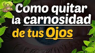 ¿Como Quitar La Carnosidad De Los Ojos Sin Cirugia [upl. by Nauqaj720]