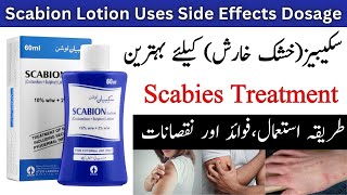 Scabion Lotion Use In Urdu  How To Use Scabion Lotion [upl. by Enneirb700]