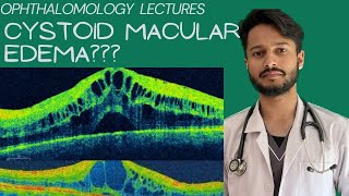 Cystoid Macular Edema  Ophthalmology lectures Retina Cee pg [upl. by Malvia]