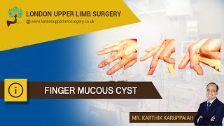 Finger mucous cyst [upl. by Akimrehs]