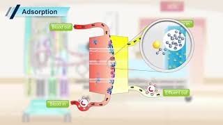 Prismaflex CRRT Transport Mechanism [upl. by Featherstone]