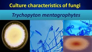 Trychopyton mentagrophytesDermatophytes you must know [upl. by Ardaid]