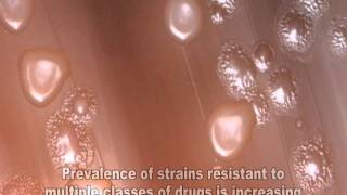 Streptococcus pneumoniae [upl. by Adne]