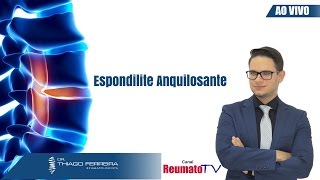 Tudo sobre Espondilite Anquilosante  Ao Vivo [upl. by Searby249]