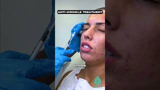 Anti wrinkle treatment [upl. by Ileana]