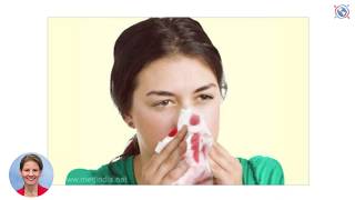 Nasal Cautery  A procedure to stop nose bleeding [upl. by Lagas]