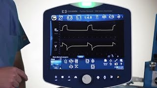 Puritan Bennett™ 980 Ventilator Basic Lesson Mode Setting Changes [upl. by Dominga]