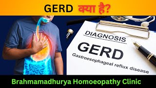 quotGERD Understanding Homeopathic Treatments and Effective Managementquot [upl. by Nahsrad891]