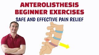 Lumbar Anterolisthesis Exercises [upl. by Jerrine411]