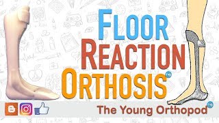 Floor Reaction Orthosis FRO [upl. by Meng218]