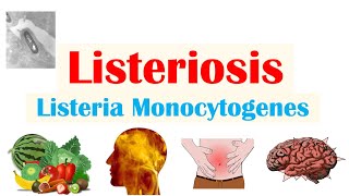 Listeriosis Listeria Monocytogenes  Sources Pathophysiology Symptoms Diagnosis Treatment [upl. by Camilla979]