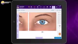 Pupillary Reflexes  OSCE Guide Clip  UKMLA  CPSA  PLAB 2 [upl. by Culbertson258]