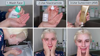 How to use a 10 Niacinamide Serum on Face [upl. by Lattimer]